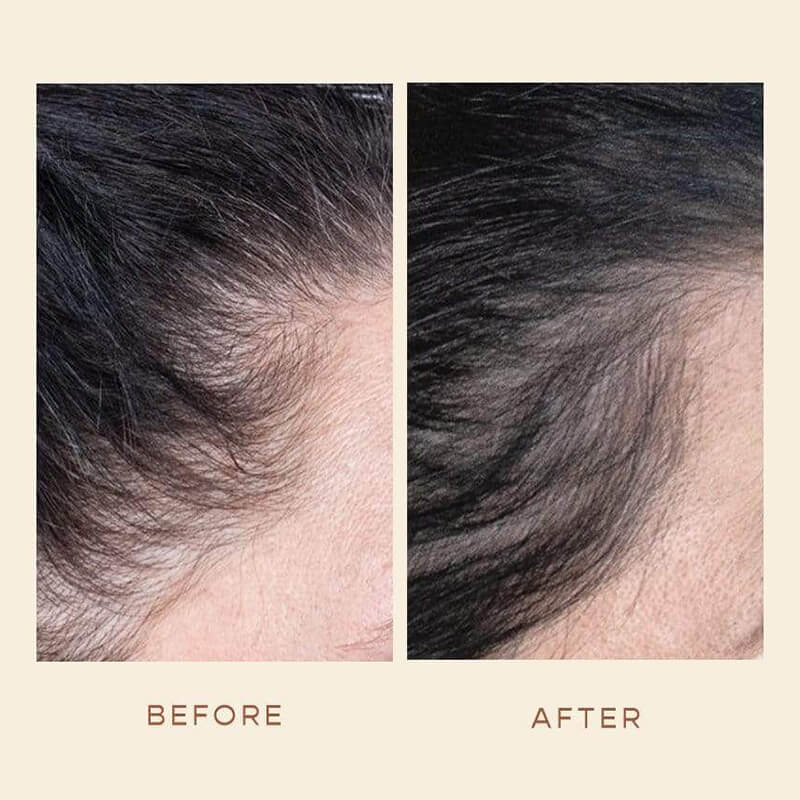 Get thicker, fuller, shinier hair